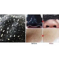 Mascara Black 60ml Mask Remove Cravos Tipo De Pele Foto mini 3