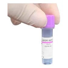 Microtubo Para Coleta De 0,5ml Com Edta K2 Com 50 unidade Foto mini 4