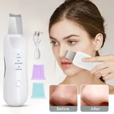 Mini Aparelho De Peeling Esfoliante Anti Cravos Acne Limpeza Foto mini 2