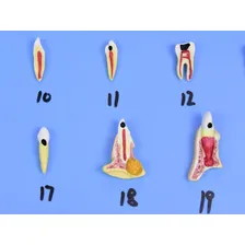 Modelo De Patologias Dentárias Em 25 Partes Em Placa Foto mini  3