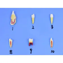 Modelo De Patologias Dentárias Em 25 Partes Em Placa Foto mini  2