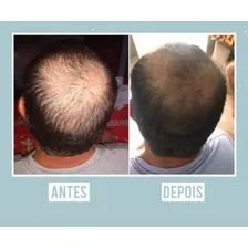Nanovin A Shampoo Krina 300ml + 2 Tonico Krina Cavalo 30ml Foto mini 3