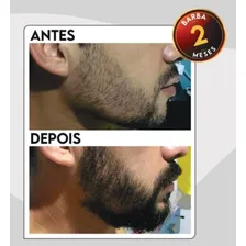 Nanovin A Shampoo Krina 300ml + 2 Tonico Krina Cavalo 30ml Foto mini 2
