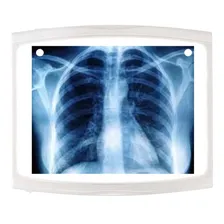 Negatoscópio Slim Led Tomográfico Biotron Foto mini  3