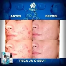 Óleo De Girassol Ozonizado Natuoz 50ml Foto mini 4