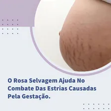 Óleo Hidratante Corporal Estrias Gestante Clareador 100ml Foto mini  2