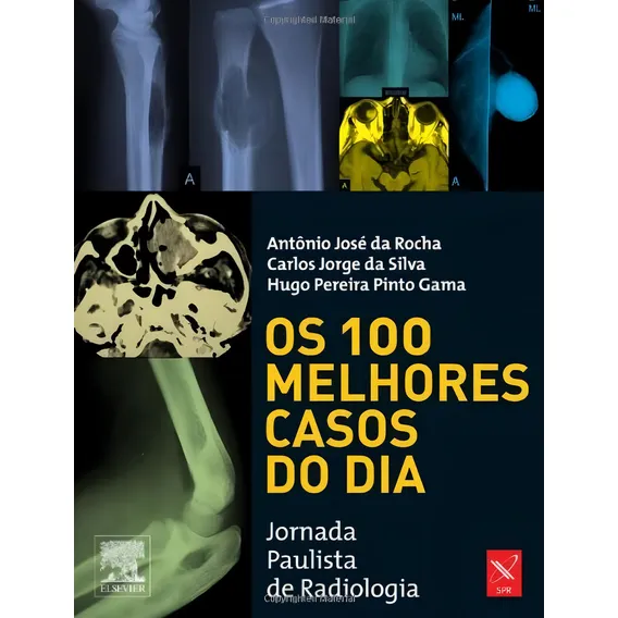 Os 100 Melhores Casos Do Dia Foto 1
