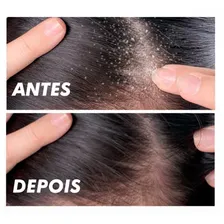 Panta Anticaspa 3 Em 1 - Shampoo, Condicionador E Anticaspa Foto mini 1