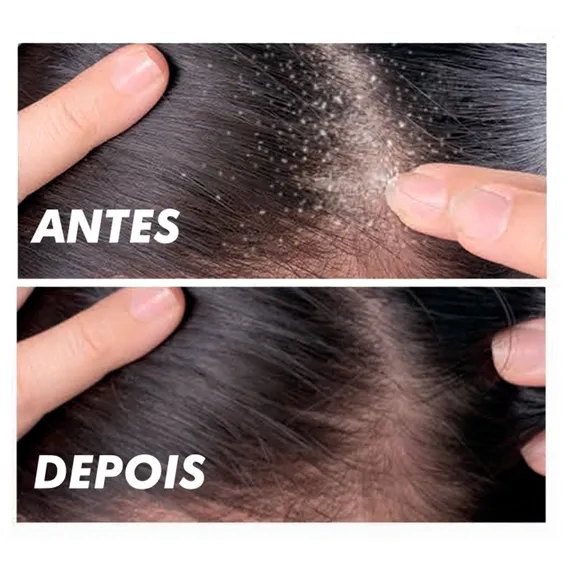 Panta Anticaspa 3 Em 1 - Shampoo, Condicionador E Anticaspa Foto 1