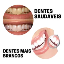 Pasta De Dentes Clareadora Kit 3 Unidades Prowhite 90g Foto mini 4