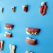 Patologia Dentárias Em 12 Peças Foto mini 3