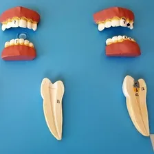 Patologia Dentárias Em 12 Peças Foto mini 2