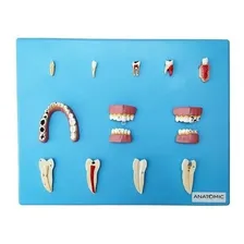 Patologia Dentárias Em 12 Peças Foto mini 1