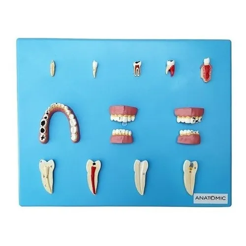 Patologia Dentárias Em 12 Peças Foto 1