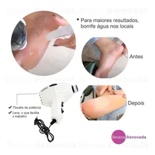 Pedicuro Elétrico Lixa Pés Mega Bell Profissional Compact 12 Lixas 220v Profissional Motor Potente x1u Foto mini  2