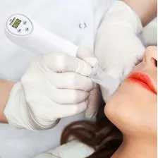Peeling Diamante Vácuo Portátil Dermo Abrasivo Bivolt Sc Foto mini 3