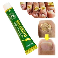 Pomada Creme Antimicótica Micose Unha Fungos Unhas Já Foto mini 1