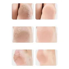 Protetor Calcanhar Silicone Gel Macio Conforto Mulher Homem Cor Rosa Foto mini 2