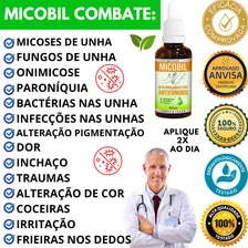 Remedio Que Tira Micose De Unha Mata Fungo Unha Mùos/pés Cor Preto Foto mini 3