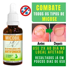 Remedio Que Tira Micose De Unha Mata Fungo Unha Mùos/pés Cor Preto Foto mini 4