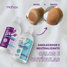 Removedor Amolecedor De Calos Rachaduras E Cutículas Procalo Foto mini 4