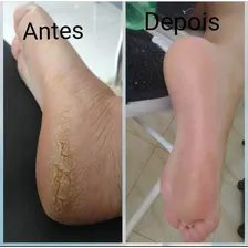 Repos 10 Amaciantes De Cutículas E Calosidades 120ml Foto mini 4