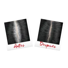 Retoque De Raiz Cor Preto Magic Retouch Loréal Paris Foto mini 2