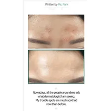 Serum Some By Mi Aha Bha Pha 30 Days Miracle Anti Acne 50ml Cosmética Coreana Foto mini  3