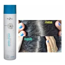 Shampoo Anti Caspa 300ml Mairibel Cosméticos Foto mini 1
