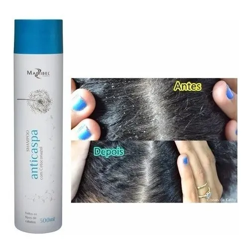 Shampoo Anti Caspa 300ml Mairibel Cosméticos Foto 1