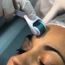 Smart Derma Roller 1,00mm - 540 Agulhas Smart GR Foto mini 4