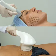 Sonofocus Ibramed - Ultrassom Focalizado E Massagem Aura Foto mini 3
