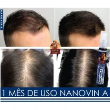 T么nico Capilar Nanovin A Krina De Cavalo 30ml Foto mini 3