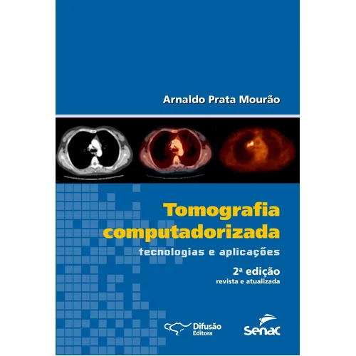 Tomografia Computadorizada Tecnologias E Aplicações: Tomografia Computadorizada Tecnologias E Aplicações, De Mourão, Arnaldo Prata. Editora Difusao, Capa Mole, Edição 2 Em Português Foto 1