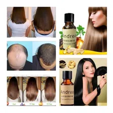 Tônica Andrea Hair Crescimento Capilar Controle D Queda 20ml Foto  mini 1