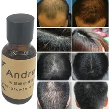 Tônica Andrea Hair Crescimento Capilar Controle D Queda 20ml Foto mini  3