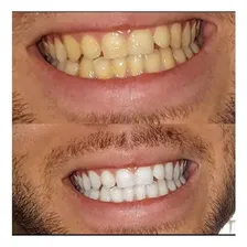 White Carvo Clareador Dental Foto mini 3